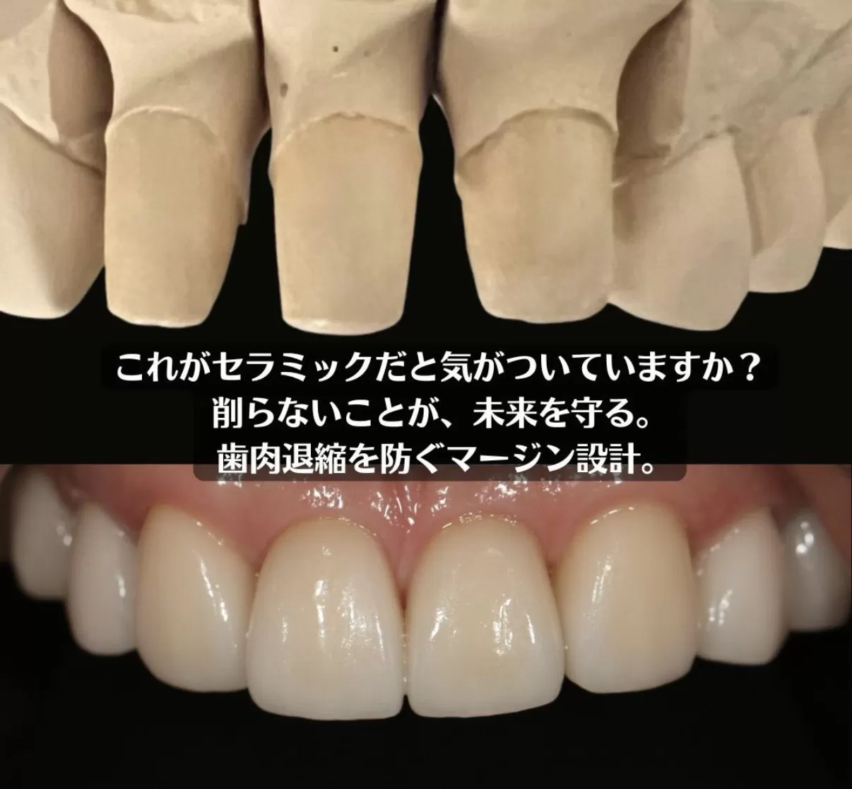 これがセラミックだと気ついていますか?
