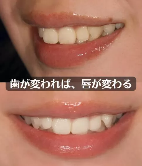 歯が変われば、唇が変わる。