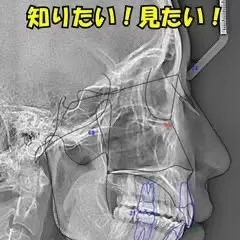 矯正する前に知りたい!見たい!