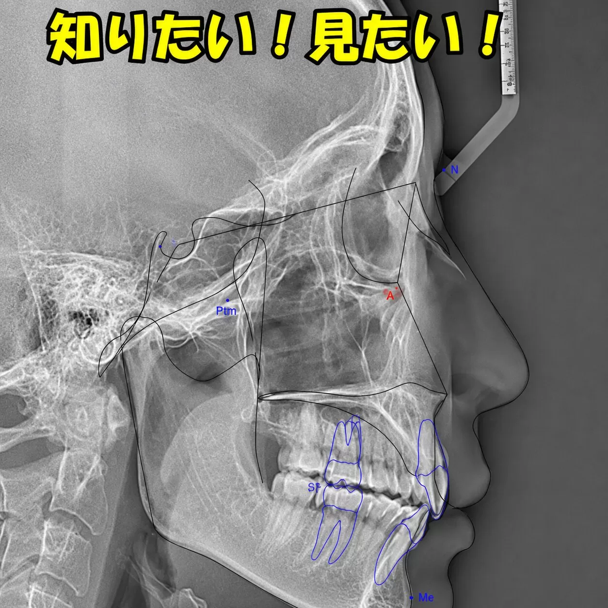 矯正する前に知りたい!見たい!